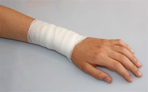 Burn Injuries | Burn Injury Attorneys Omaha : Hauptman, O'Brien, Wolf & Lathrop, P.C.