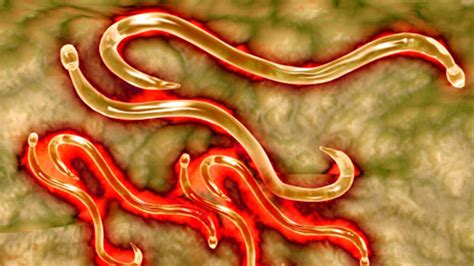 4 Signs You're Infected With a Parasite | HowStuffWorks