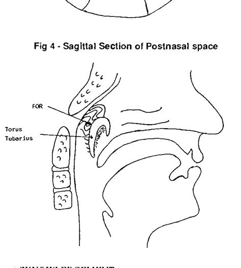 Structure of pharyngeal recess | Semantic Scholar