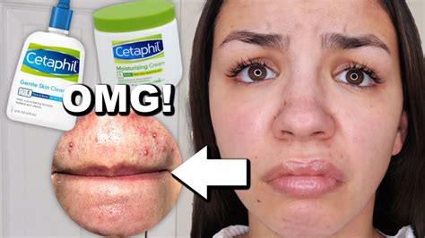 I used cetaphil skincare for one week! - Audrey Victoria