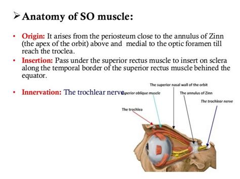 Superior oblique palsy