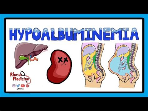 Hyperalbuminemia - What Is It? Symptoms And Treatment | Encyclopedia 2024