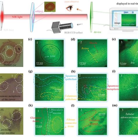 Bioimaging applications of the NIR‐OPD. a) Schematic diagram of ...