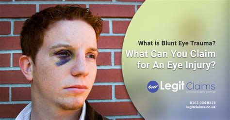 The Steps of Claiming for a Blunt Eye Trauma - LEGIT CLAIMS | PERSONAL INJURY SOLICITORS