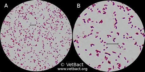 Salmonella enterica subsp. enterica