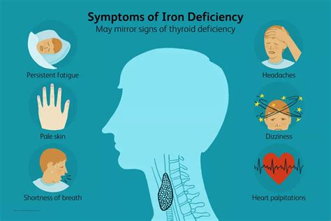 Iron Deficiency Symptoms That You Shouldn’t Ignore - Healthy Lifestyle