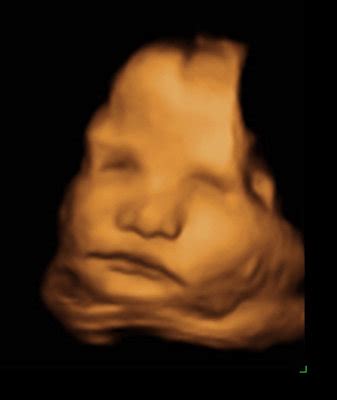 3d Ultrasound Pictures Pregnancy :: 3d Puzzle Image