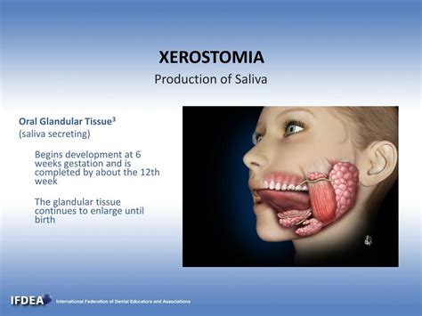 Xerostomia Meaning