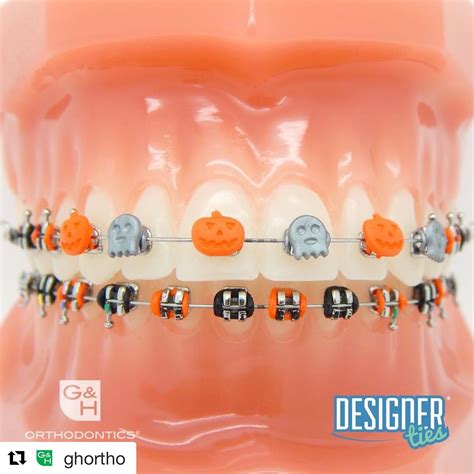 cute braces colors for halloween - Rueben Downey