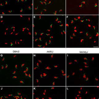 Effects of miglustat on acrosomal proteins as detected by western ...