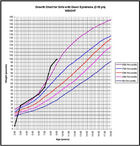 Down Syndrome Growth Chart