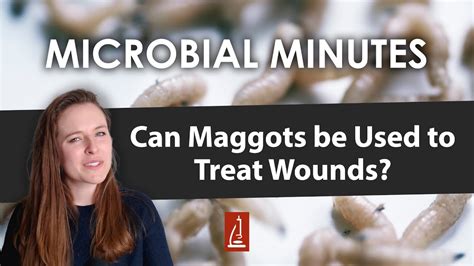 Maggot Therapy for Treating Wounds - Diabetes