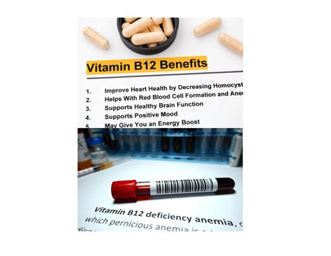 Vitamin B12 Deficiency In The Elderly