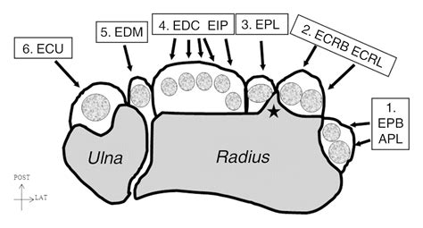 Image result for extensor retinaculum and wrist phones | Physical therapy school, Hand therapy ...