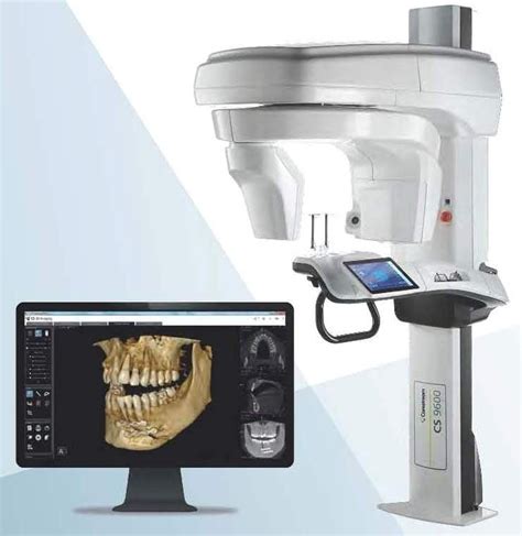 CBCT Imaging (Cone Beam Computed Tomography) Webster TX, Oral Surgery Associates