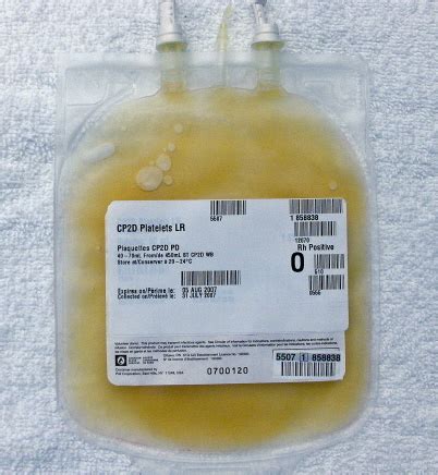 Platelet concentrate