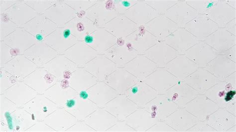 Cosmarium whole mount filmed against bright field under microscope with 100x magnification ...