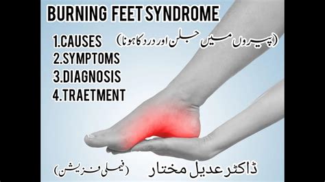 Feet Burning Symptoms at Helen Bates blog