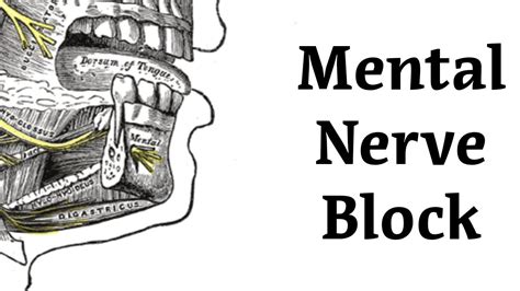 Mental Nerve Block Procedure - YouTube