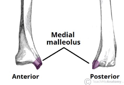 Tibial Plafond