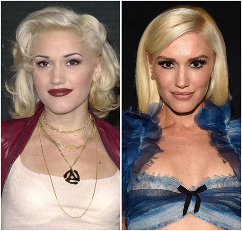 What Did Gwen Stefani Look Like Before Plastic Surgery? See Pics!