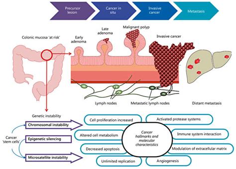 Schematic depiction of the adenoma-carcinoma-metastasis process. The ...