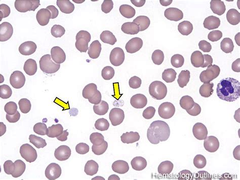 hypogranular platelet atlas : Biological Science Picture Directory – Pulpbits.net