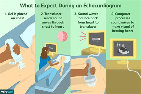 Echocardiogram: Uses, Side Effects, Procedure, Results