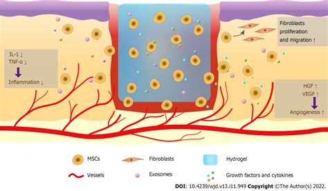 Combination therapy of hydrogel and stem cells for diabetic wound healing