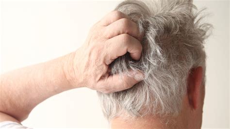 What Causes Scalp Tenderness?