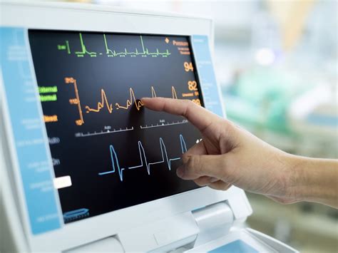 Book an Electrocardiogram (ECG)