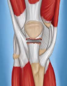 Patellar Tendon Tear - OrthoInfo - AAOS