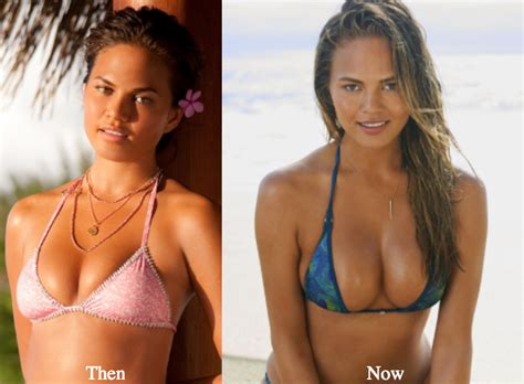 Chrissy Teigen Plastic Surgery Before and After Photos - Latest Plastic Surgery Gossip And News ...