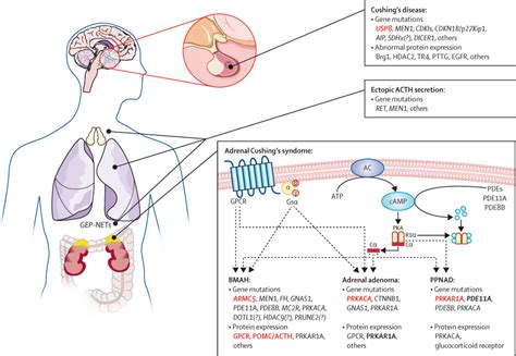 Cushing's syndrome - The Lancet