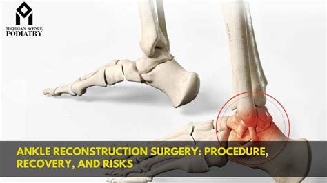 Ankle Reconstruction Surgery: Procedure, Recovery, And Risks