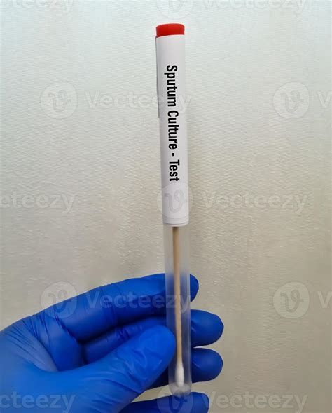 Sputum Culture Test for the diagnosis of Tuberculosis or TB 20450249 Stock Photo at Vecteezy