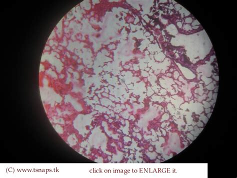 Histology Slides Database Lung Histology Slide | Images and Photos finder