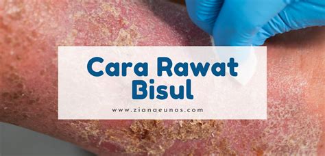 Rawat bisul dengan cara lebih berkesan | Suplemen Shaklee untuk bisul