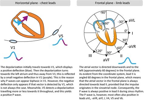 P-wave, PR interval, PR segment: physiology, criteria & ECG findings – ECG & ECHO