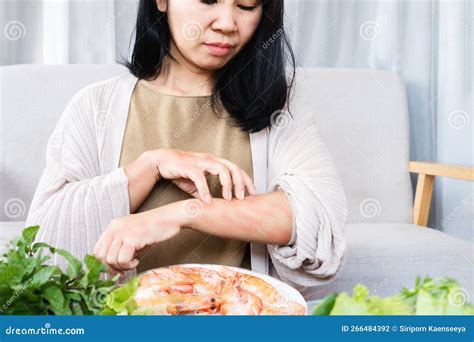 Asian Woman Itching Rashes Skin and Scratching Her Arms Caused by Food ...