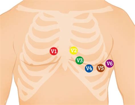 12-Lead ECG Placement Guide with | Paramedic student, Emt study, Pharmacology nursing