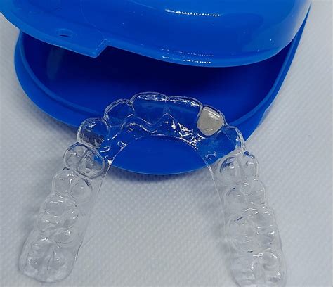 Essix Partial Denture Retainer - Dental Lab Direct