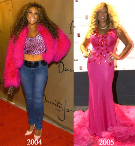 Wendy Williams Plastic Surgery Before and After Photos