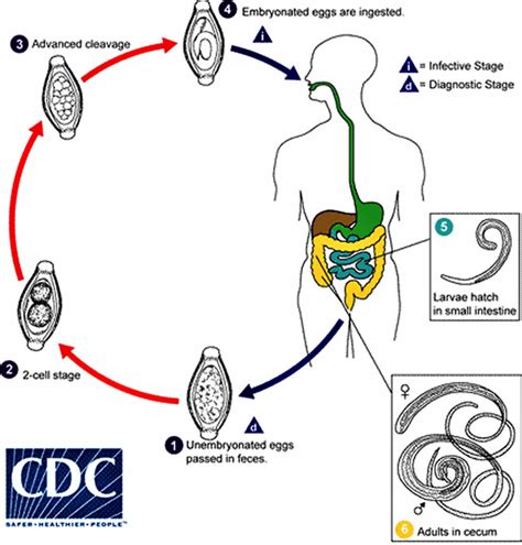 Trichuris trichiura infection, transmission, lifee cycle, symptoms ...