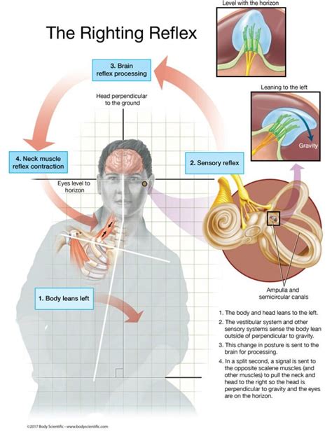 Optical Righting Reflex Infants