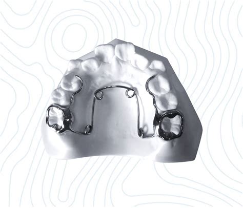 Quad Helix Ortho Appliance | Quad Helix Orthodontics Expander