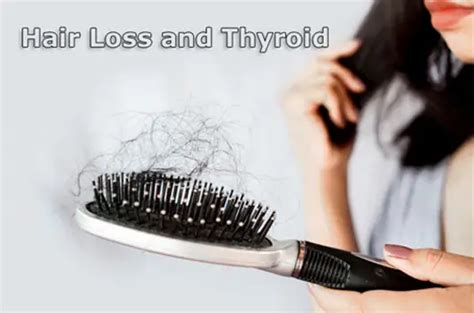 Thyroid and Hair Loss - Symptoms, Causes, Treatments - Why Thyroid