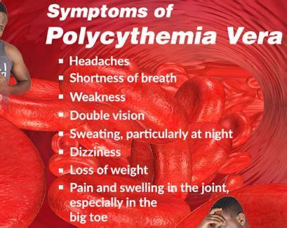 Pin on Polycythemia vera