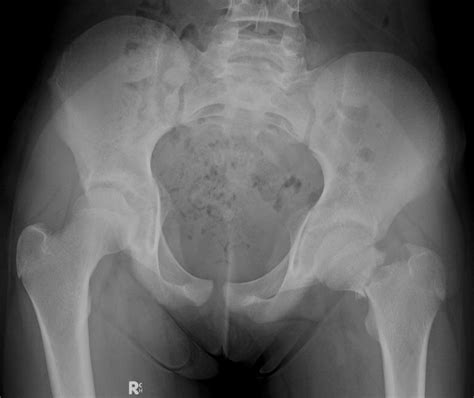 Orthopaedics Clinical Posting: Life of a Year 3 Medical Student - The ...