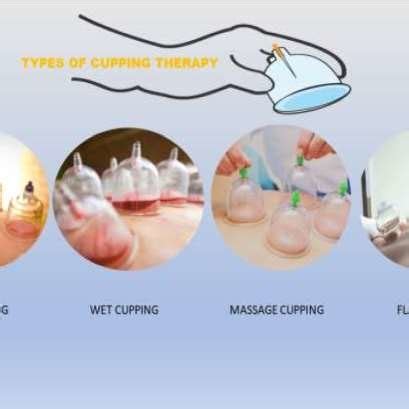 Types of Cupping therapy | Download Scientific Diagram